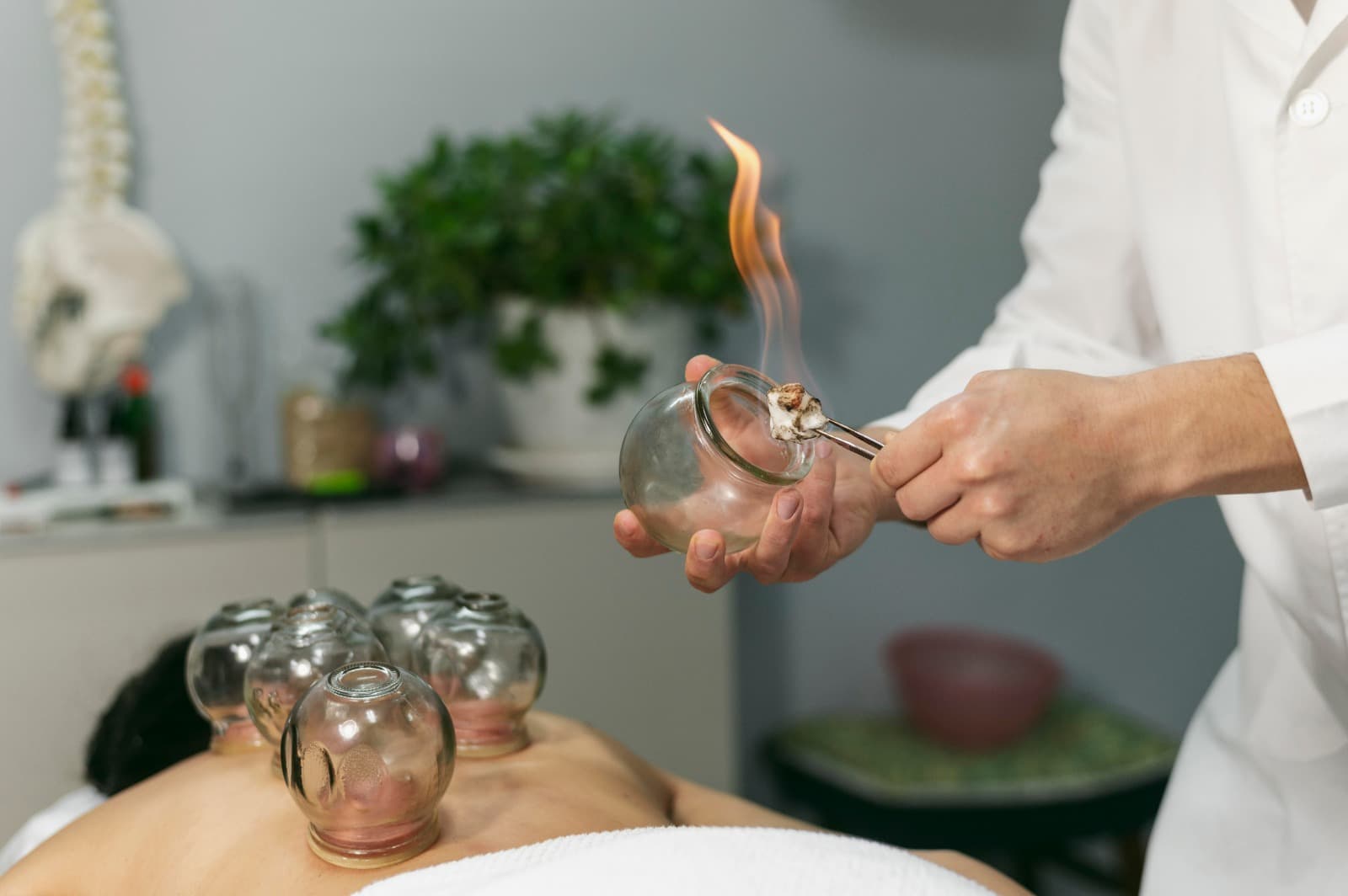 Hijama Therapy